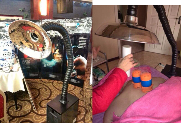 艾灸煙霧凈化圖片/艾灸煙霧凈化樣板圖 (4)