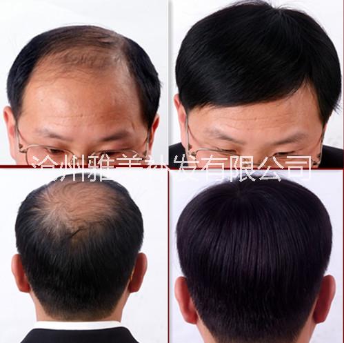 南皮圖片/南皮樣板圖 (2)