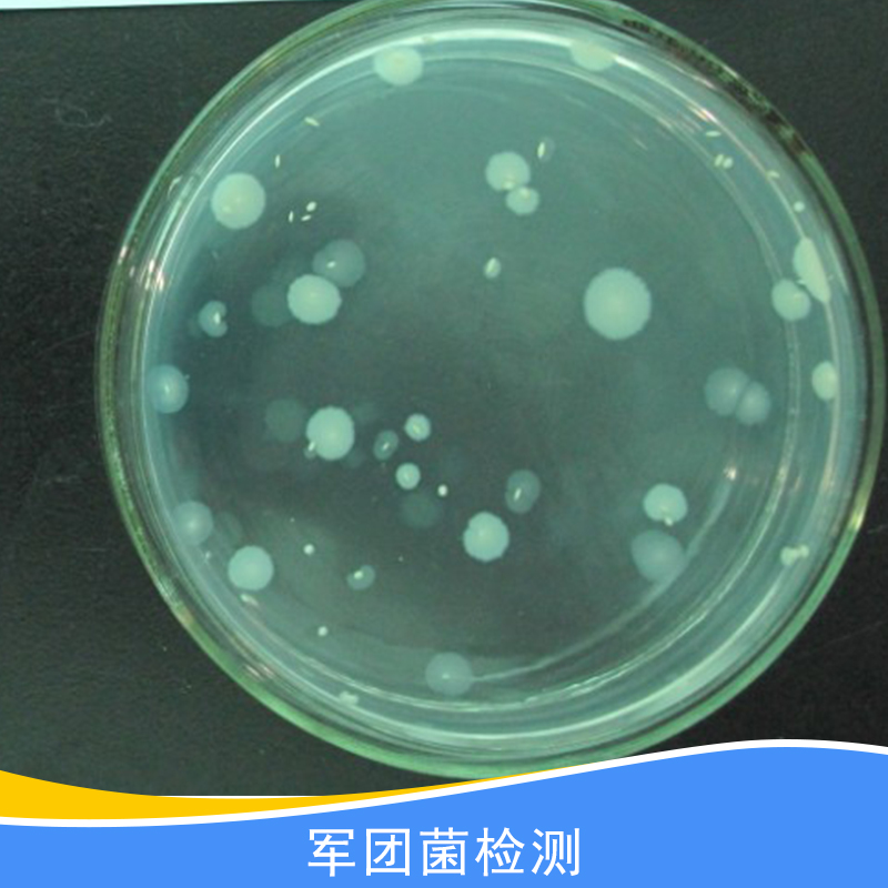 軍團菌檢測圖片/軍團菌檢測樣板圖 (4)