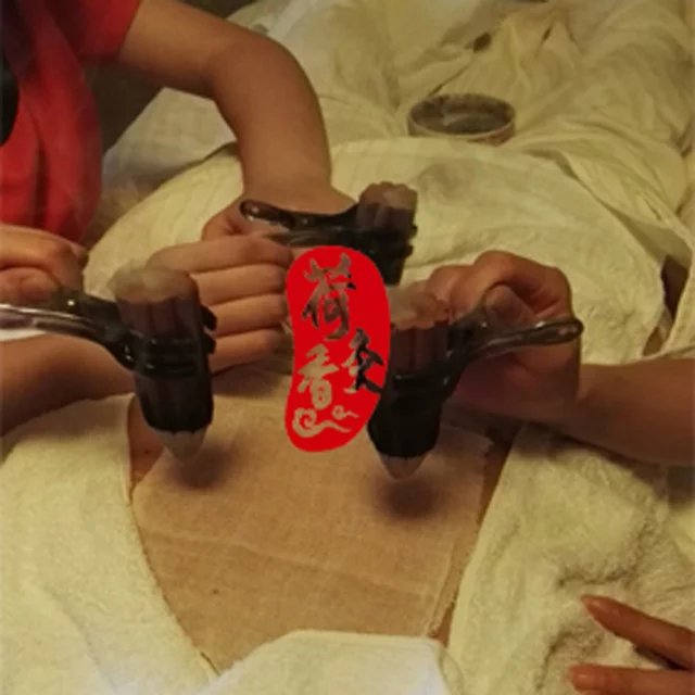 婦科卵巢理療灸蓮6圖片