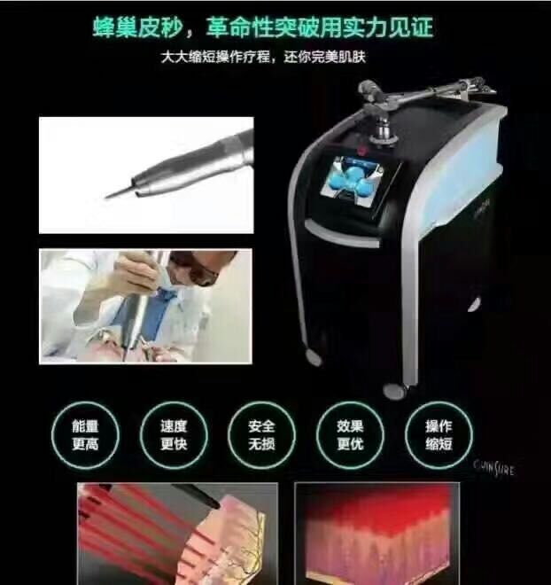 皮秒 （頂級除斑神器） 廠家直銷圖片