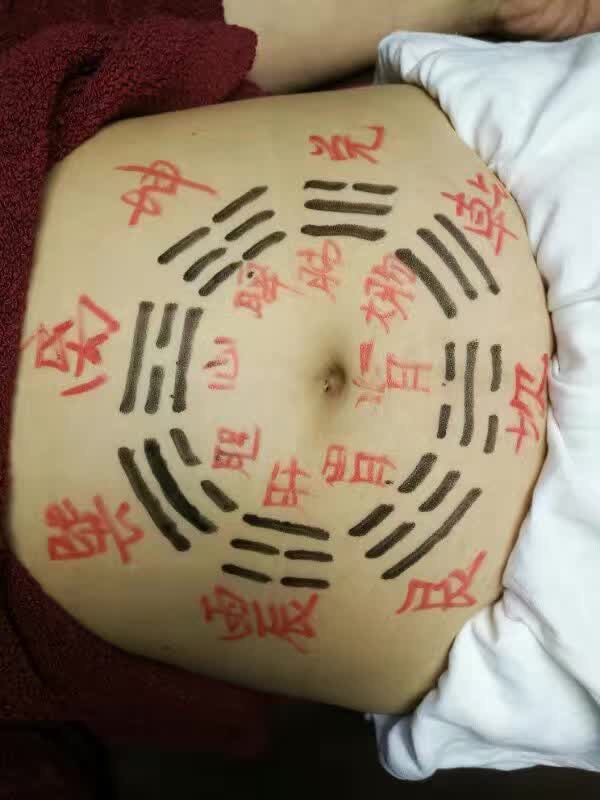 針灸培訓(xùn)圖片/針灸培訓(xùn)樣板圖 (4)