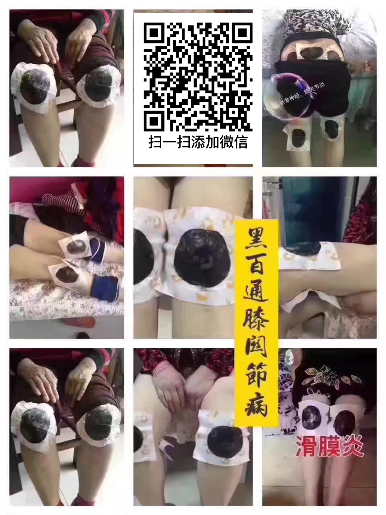 黑百通醫(yī)貼膏升級版團(tuán)購價*中  黑百通牌痛可貼