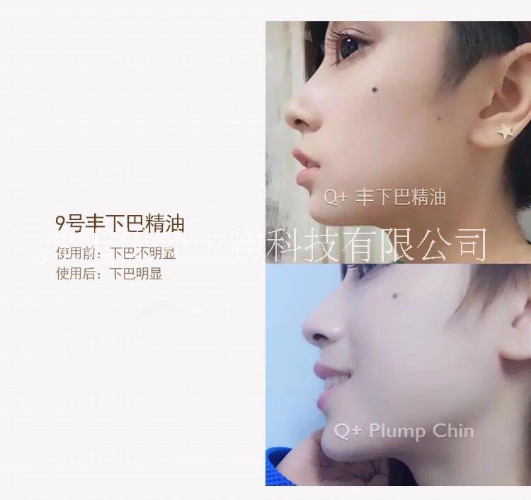豐下巴圖片/豐下巴樣板圖 (2)