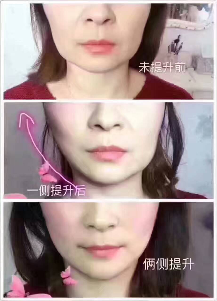 無針霧化微雕培訓圖片/無針霧化微雕培訓樣板圖 (4)