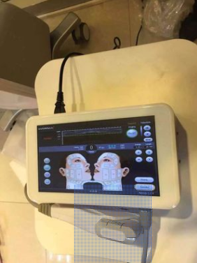 便攜臺式美版家用超聲刀 美容儀圖片/便攜臺式美版家用超聲刀 美容儀樣板圖 (2)