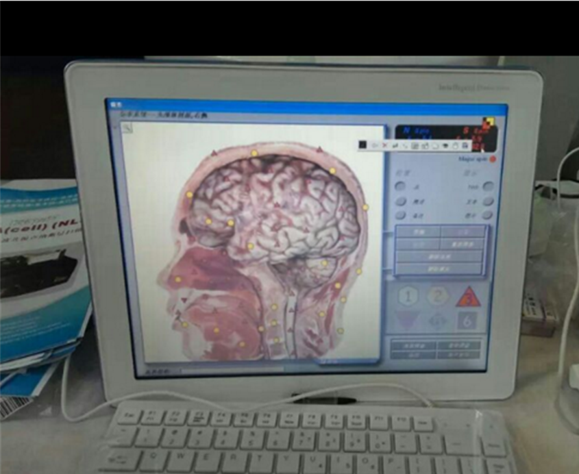 亞健康圖片/亞健康樣板圖 (2)