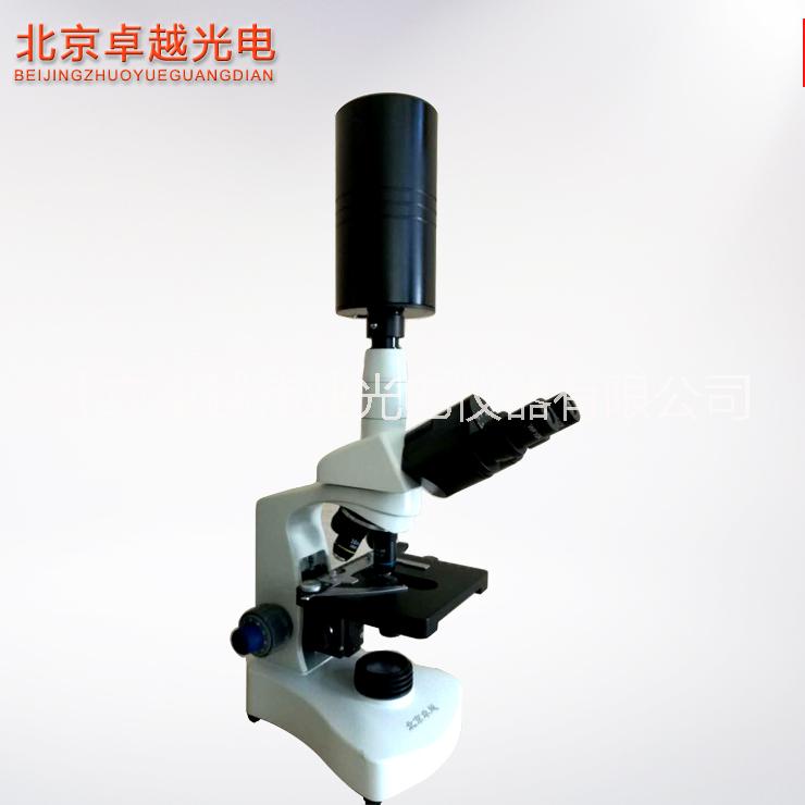 北京卓越 雙目黑背景一滴血檢測(cè)儀圖片