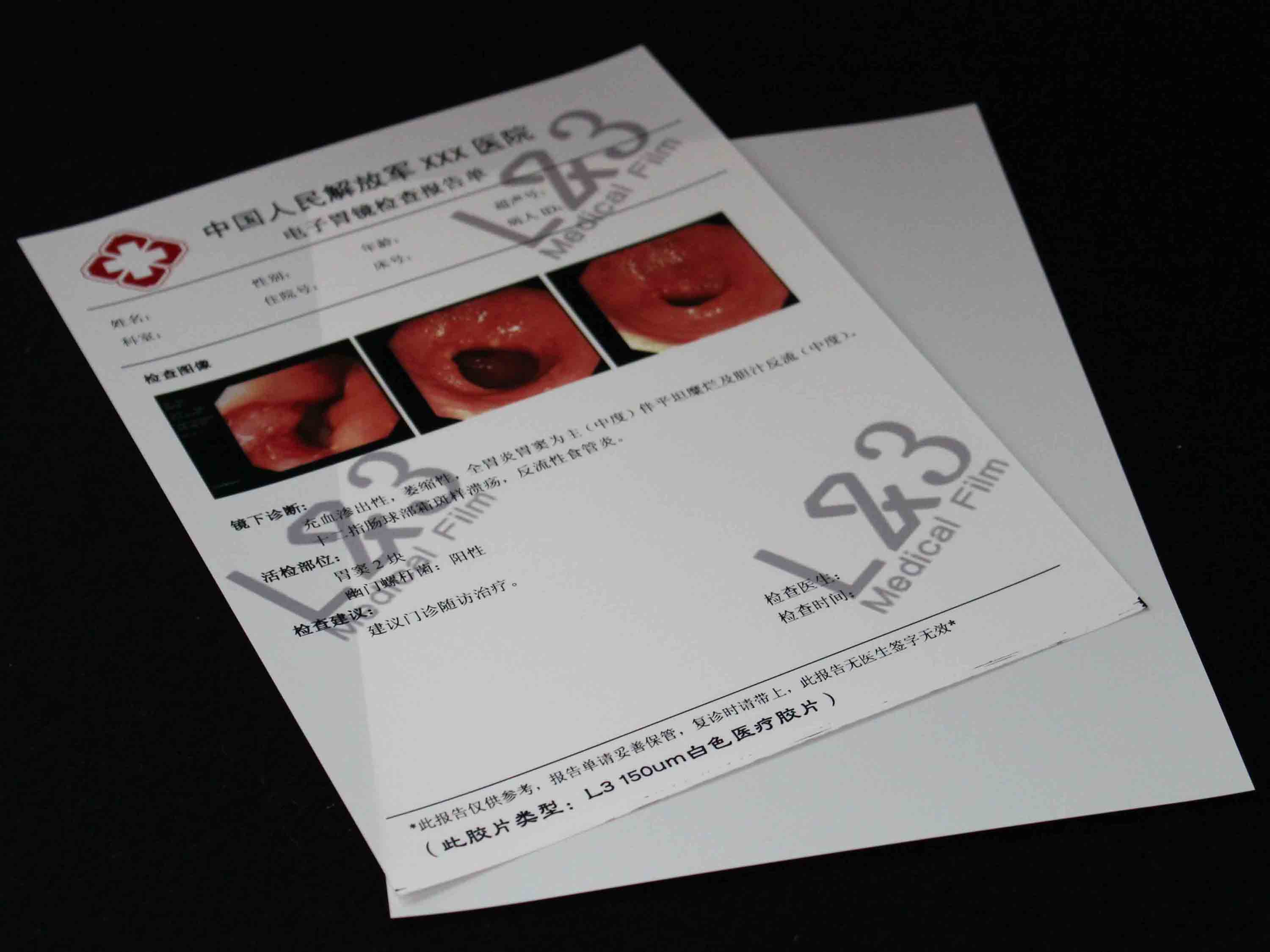 醫(yī)用干式膠片圖片/醫(yī)用干式膠片樣板圖 (2)