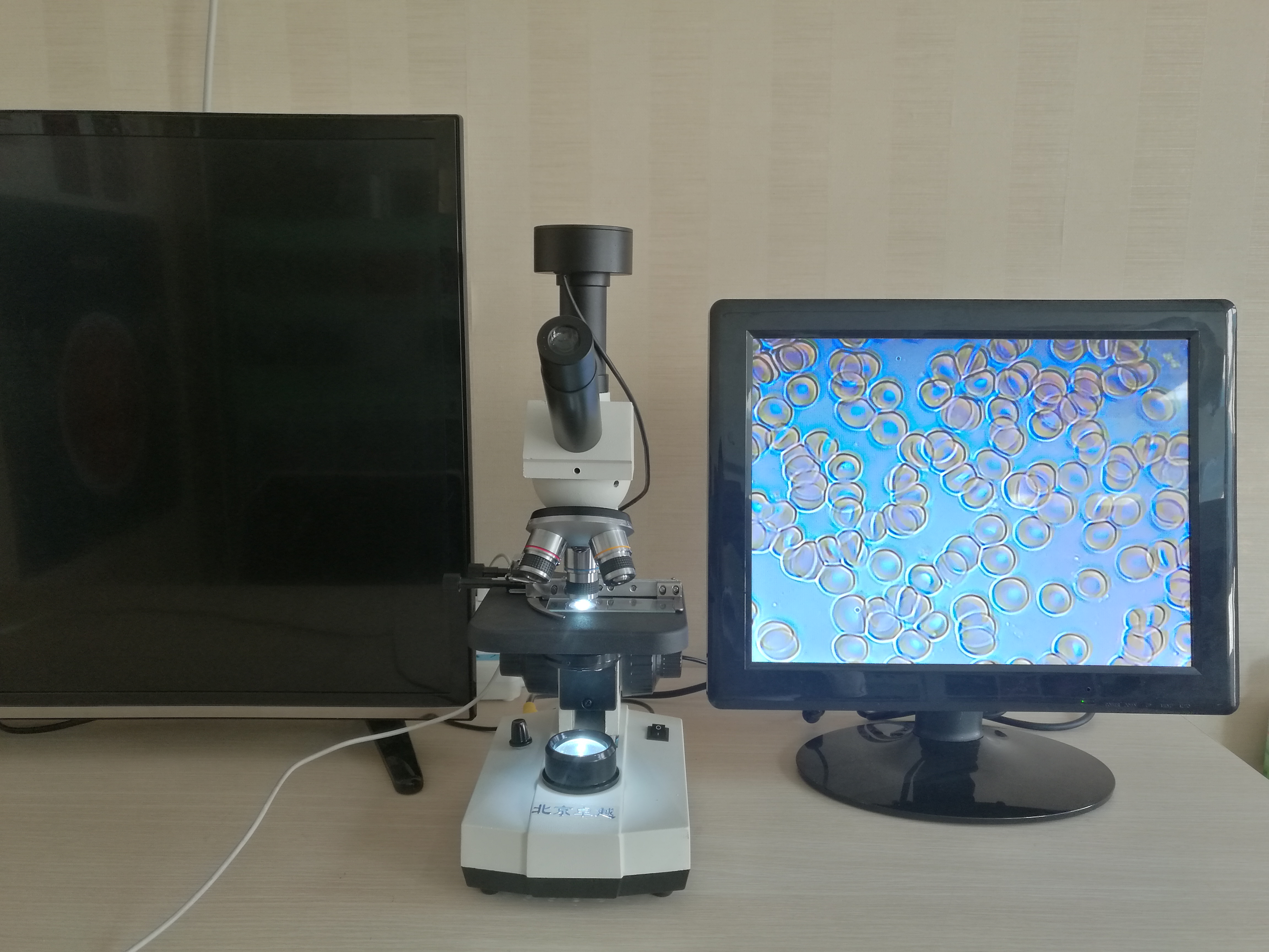 滴血檢測儀圖片/滴血檢測儀樣板圖 (3)