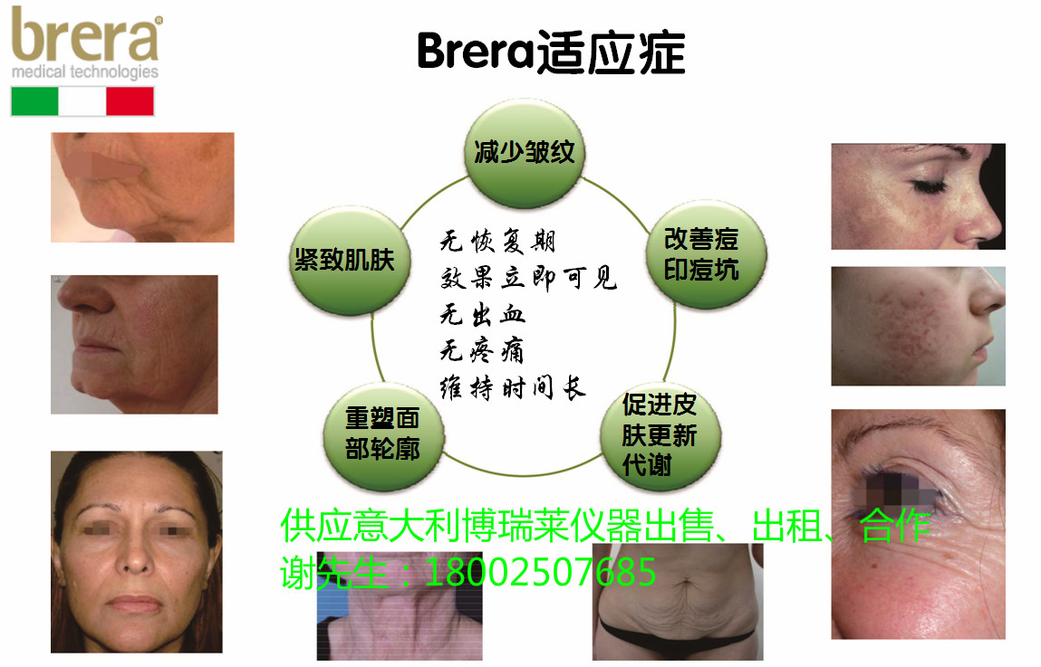 意大利博瑞萊brera圖片/意大利博瑞萊brera樣板圖 (3)