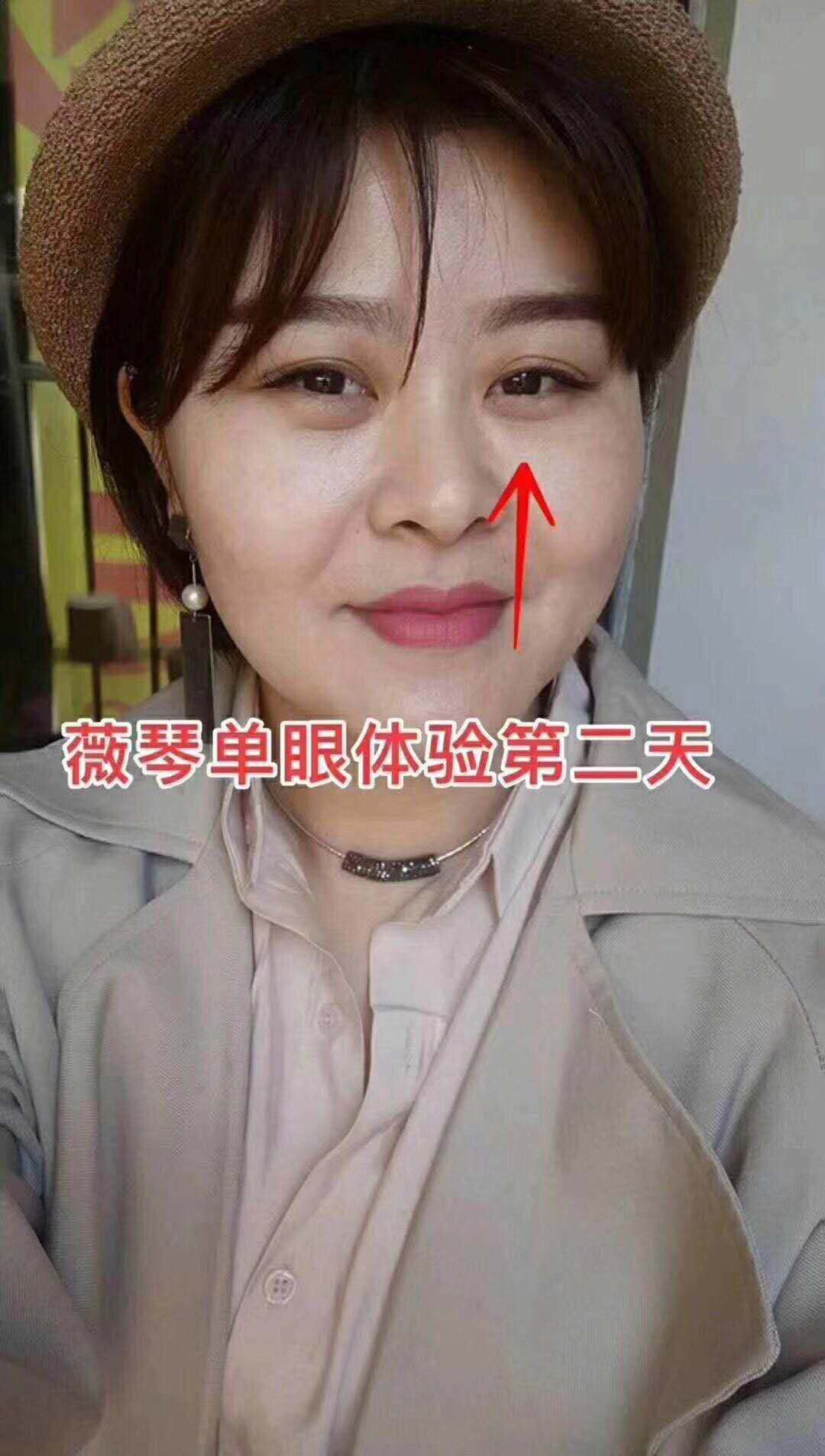 去皺抗衰圖片/去皺抗衰樣板圖 (3)
