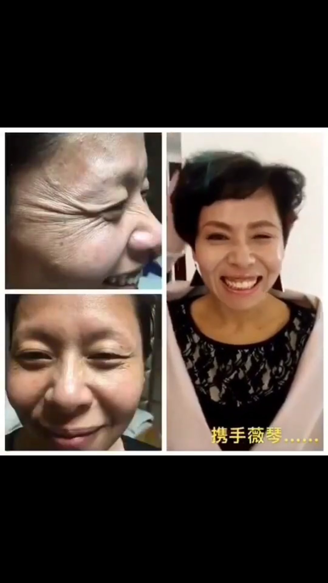 薇琴霧化去皺天士力落地項(xiàng)目圖片/薇琴霧化去皺天士力落地項(xiàng)目樣板圖 (2)