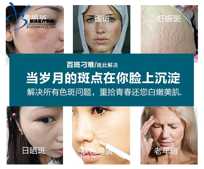 蜂巢皮秒激光，激光頭祛斑凈斑儀器圖片/蜂巢皮秒激光，激光頭祛斑凈斑儀器樣板圖 (4)