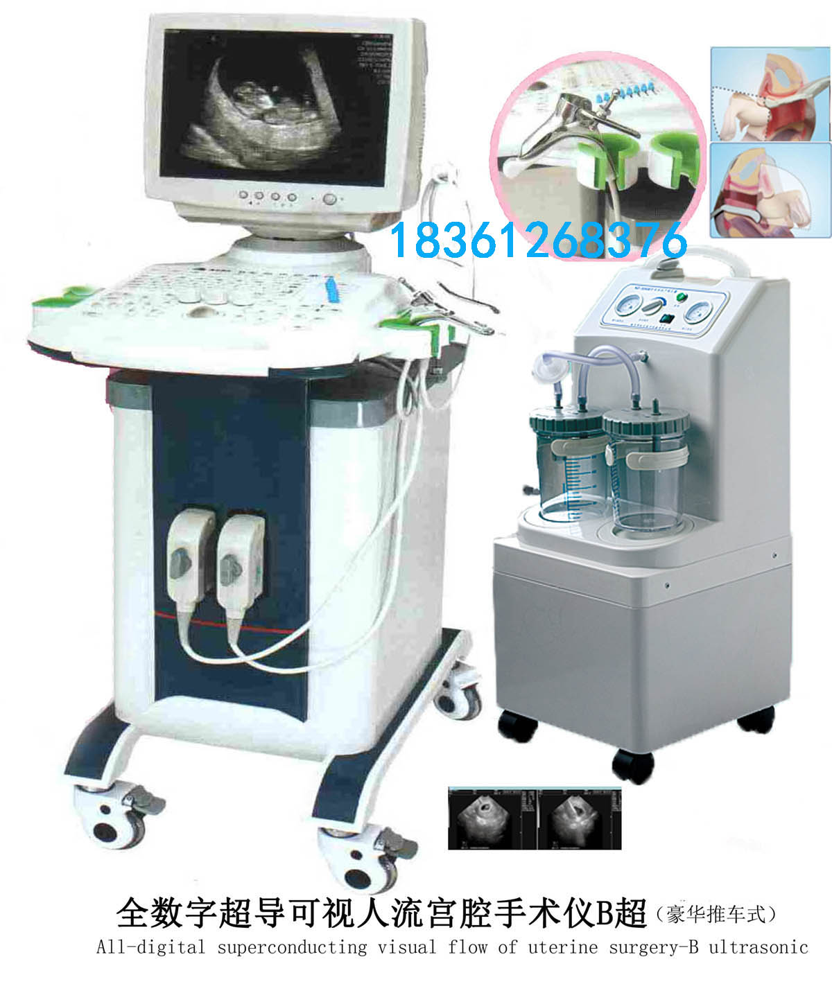 型超聲診斷儀圖片/型超聲診斷儀樣板圖 (4)