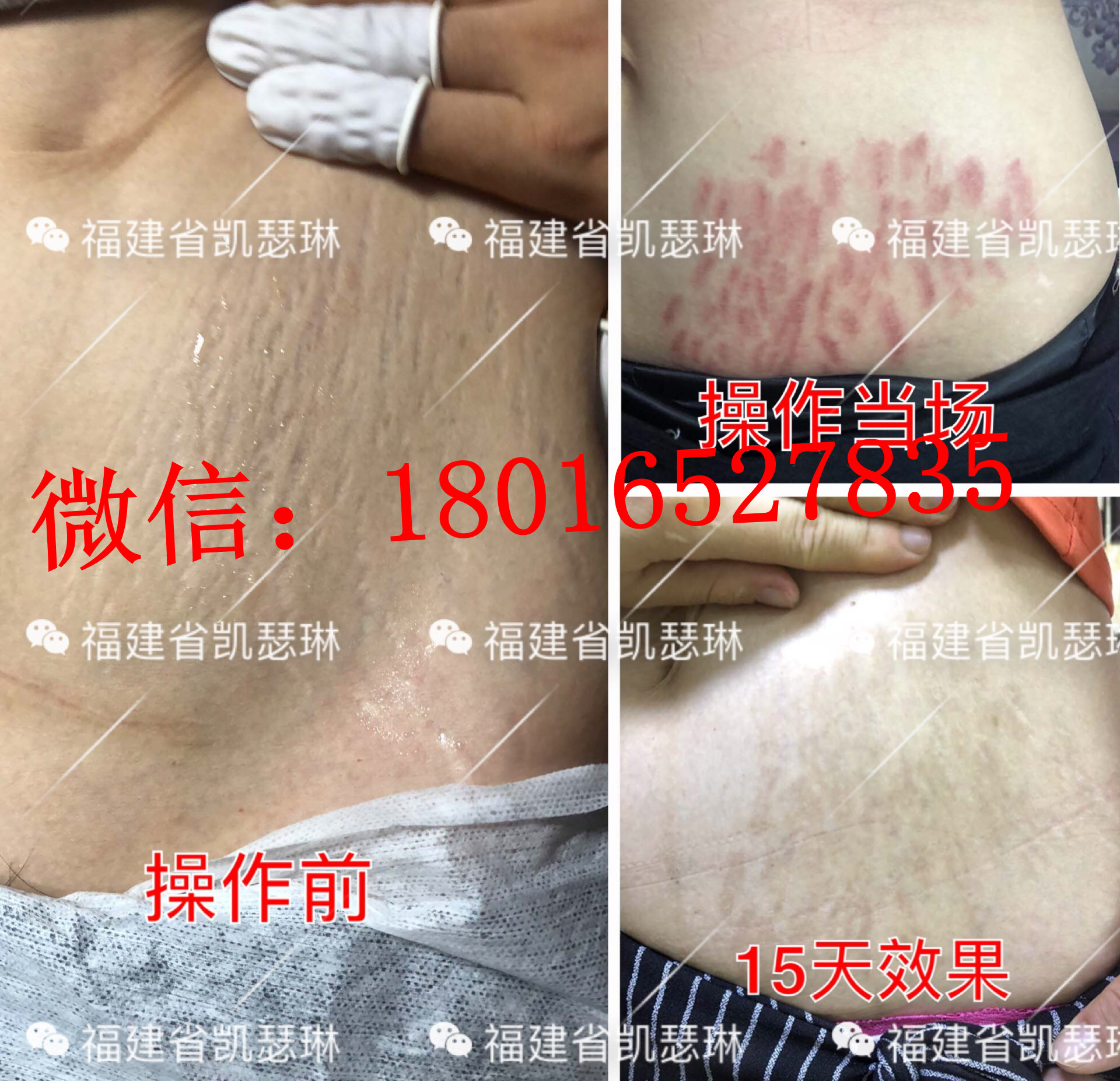 四平博仕后*修復(fù)加盟多少錢