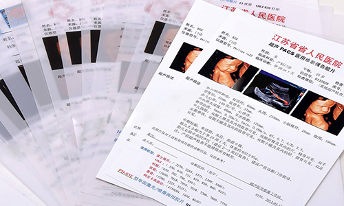 醫(yī)用打印膠片圖片/醫(yī)用打印膠片樣板圖 (2)