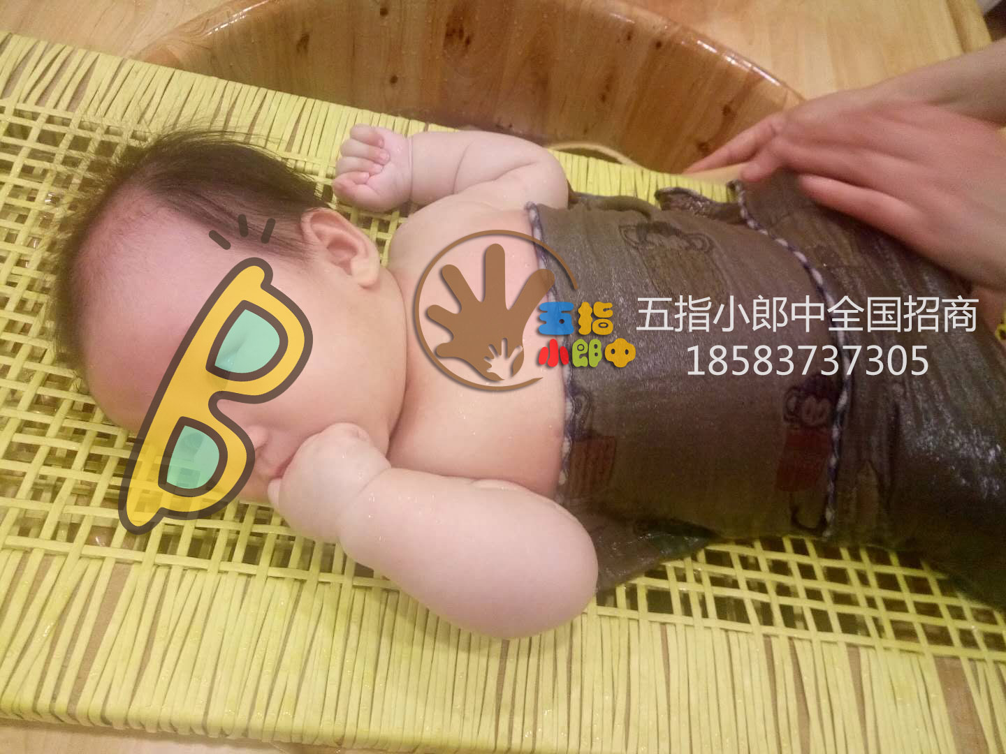 小儿药浴前景图片