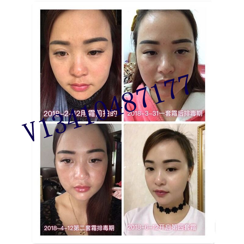 日霜晚霜圖片/日霜晚霜樣板圖 (3)