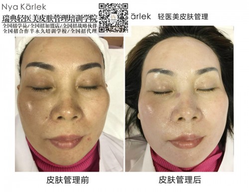 排毒套圖片/排毒套樣板圖 (4)