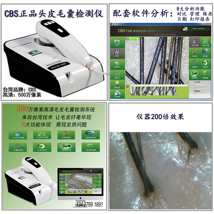 供应CBS500万高清头皮毛发检测仪头发检测仪 养发馆用头皮检测仪