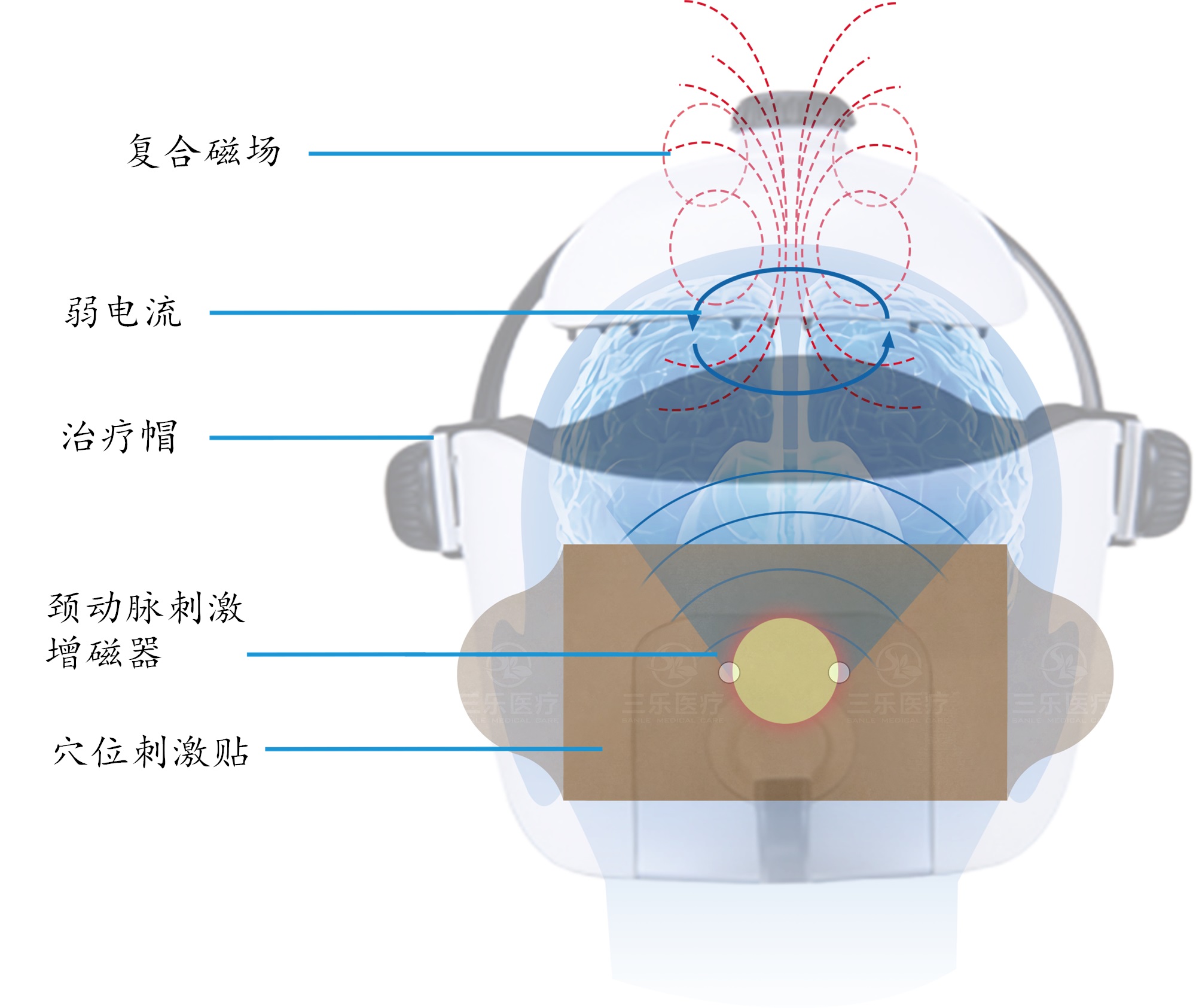 脑循环治疗仪 脑循环功能障碍治疗仪图片