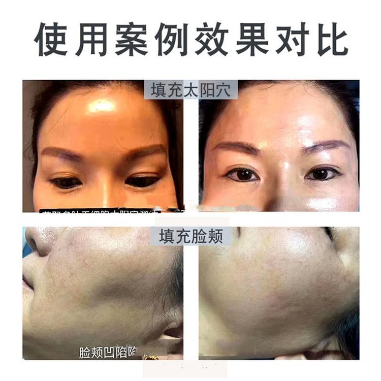 葡聚多肽細(xì)胞J活圖片