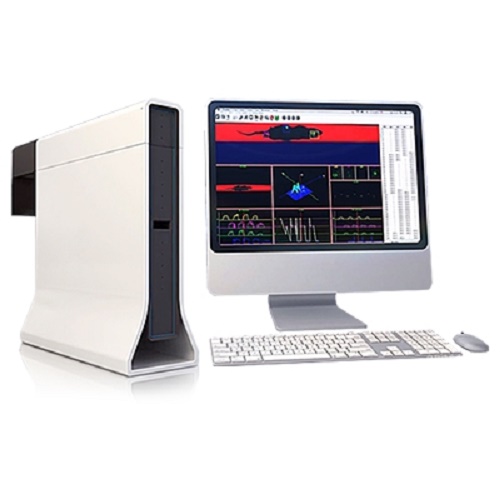 步態(tài)分析圖片/步態(tài)分析樣板圖 (1)