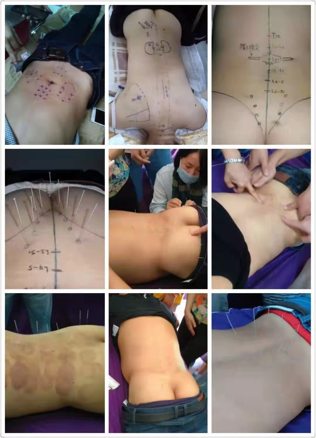 廣州零基礎(chǔ)針灸推拿正骨全科班