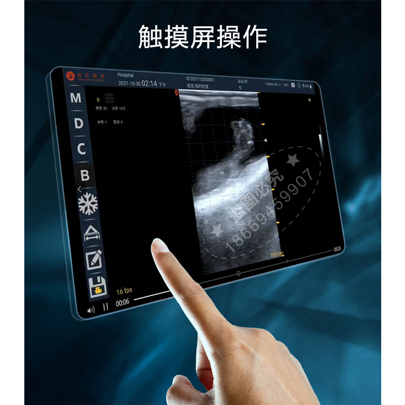 陜西 供應(yīng)高清獸用B超機(jī)廠商，便攜式掌上豬羊B超機(jī)批發(fā)價格