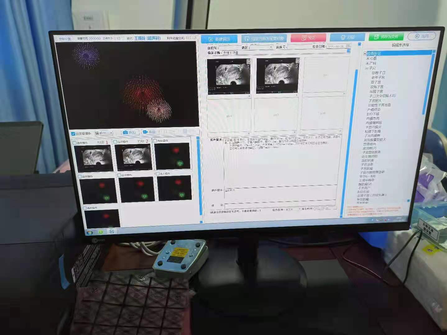 鼻窦镜 鼻窦镜影像工作站