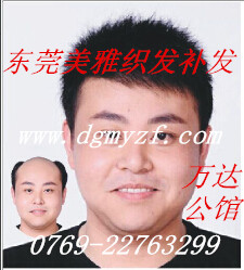 東莞織發(fā)價(jià)格 哪家好 實(shí)體 電話(huà) 麻涌織發(fā)價(jià)格
