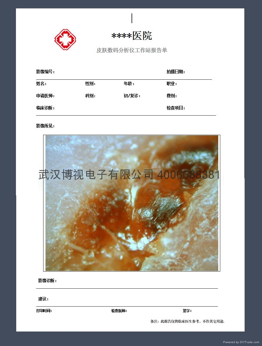 供應(yīng)電子皮膚鏡 專業(yè)電子皮膚鏡 CBS電子皮膚鏡廠家 皮膚鏡價格