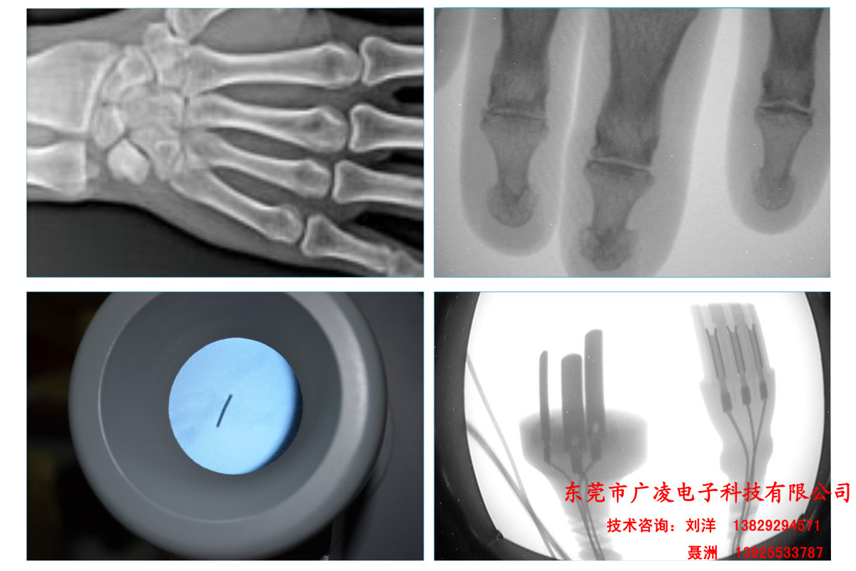 X射線探傷儀 便攜式射線探傷儀 X光探傷儀 X光機檢測 便攜式X射線探傷儀 *  便攜式X射線探傷儀 * 射線