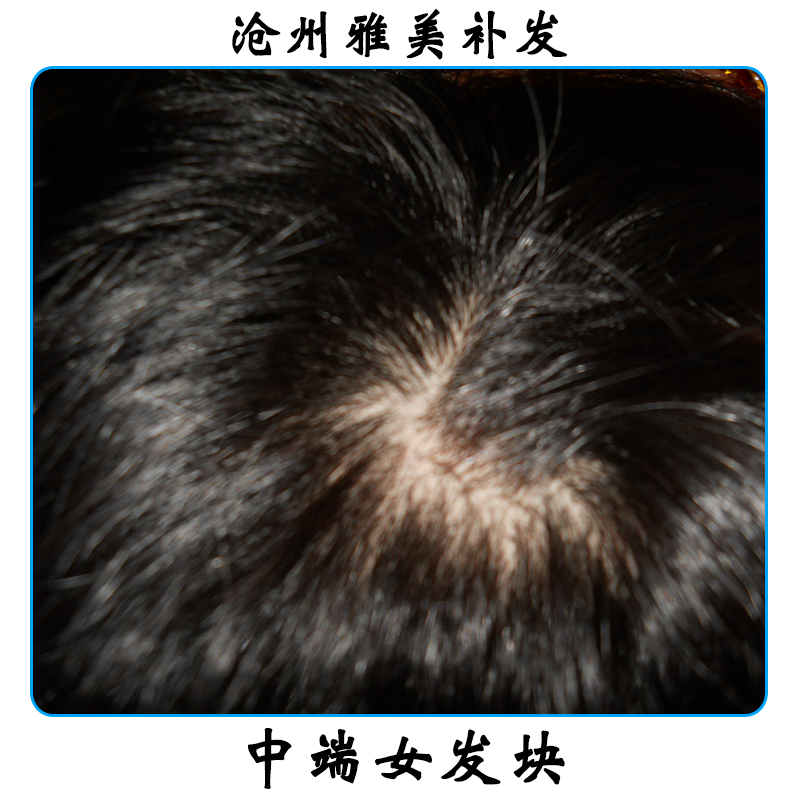 中端女發(fā)塊 透氣隱無(wú)痕補(bǔ)發(fā)發(fā)塊 真人發(fā)女士發(fā)塊 假發(fā)纖維網(wǎng)發(fā)塊
