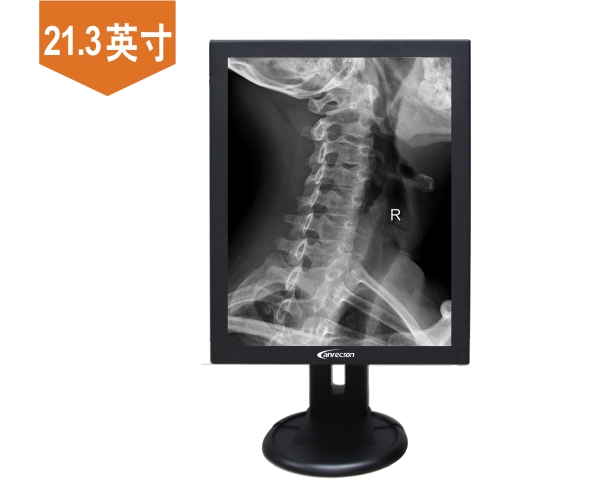 5M灰階閱片醫(yī)用顯示器