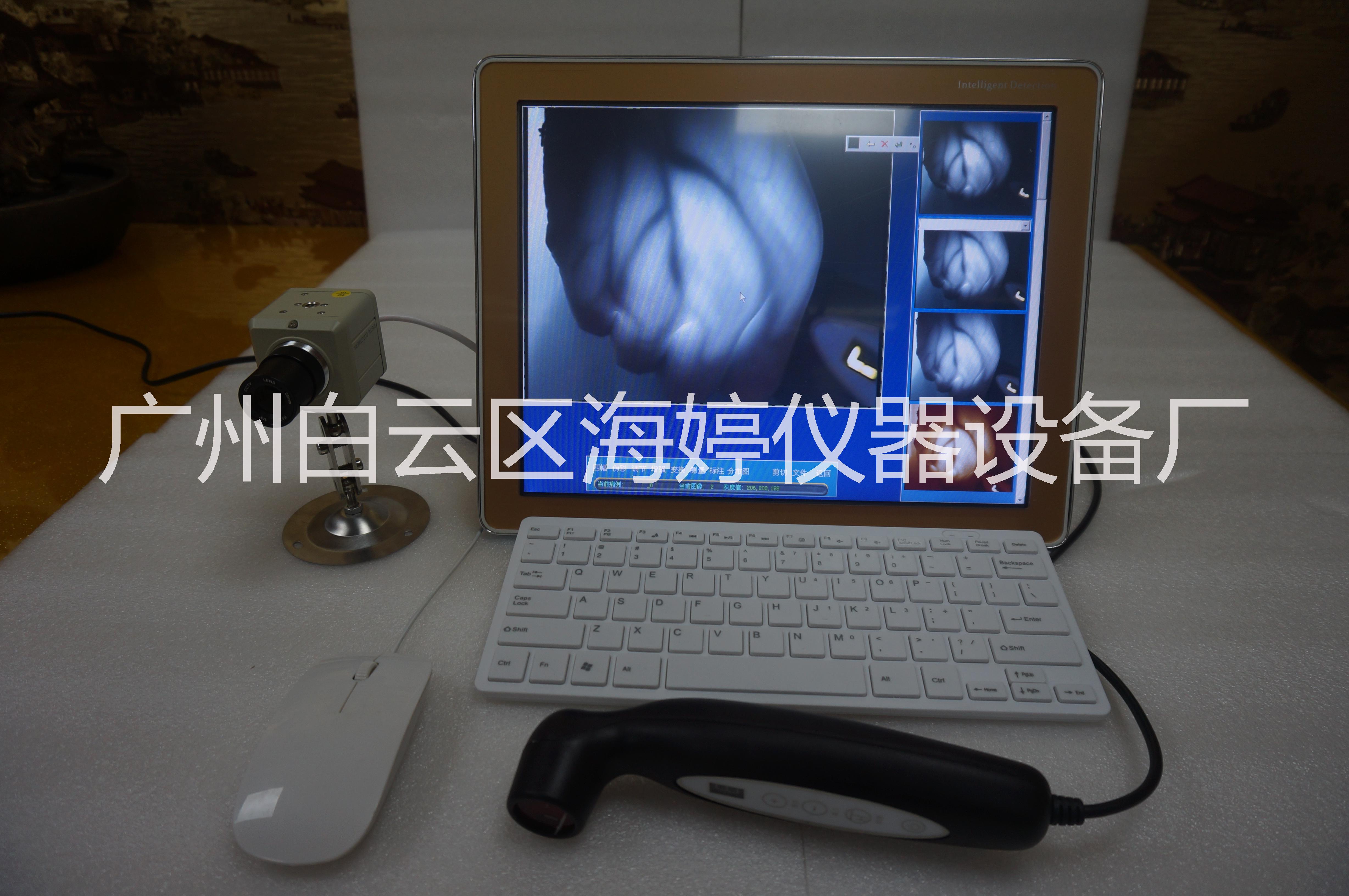 新款非觸摸乳腺檢測儀 廣州乳腺檢測儀*廠家 乳腺檢測儀直銷
