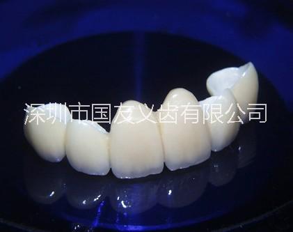 德國進(jìn)口威蘭德二氧化鋯全瓷牙 深圳廠家優(yōu)惠*直供