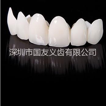 深圳全瓷牙 常見的幾種全瓷牙 二氧化鋯全瓷牙進(jìn)口材料 深圳優(yōu)惠*直銷