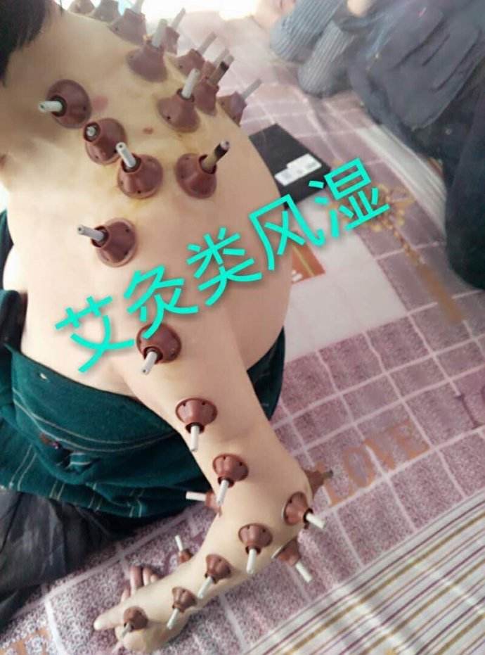 創(chuàng)業(yè) 艾灸艾艾貼