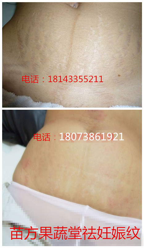 湖南*修復(fù)中心 苗方果蔬堂國(guó)內(nèi)招美容加盟代理