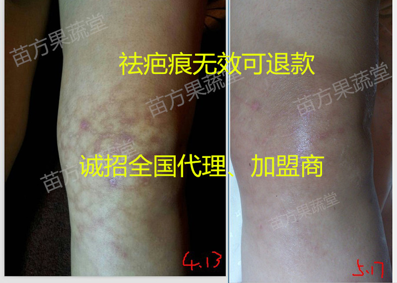 苗方果蔬堂全國招*痕加盟商合作商
