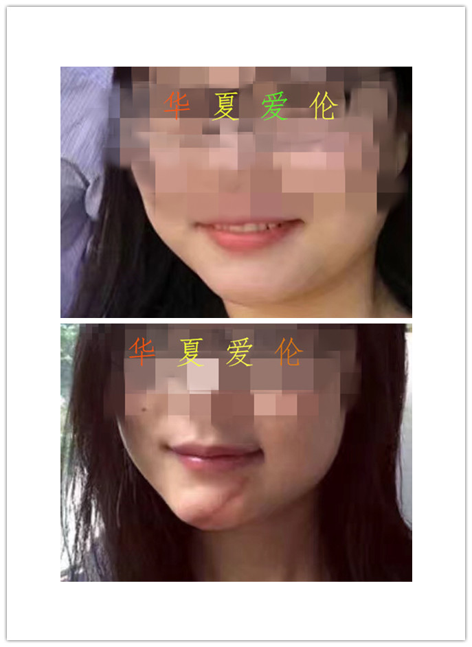 重慶*修復(fù) 重慶如何淡化*  重慶簽約*