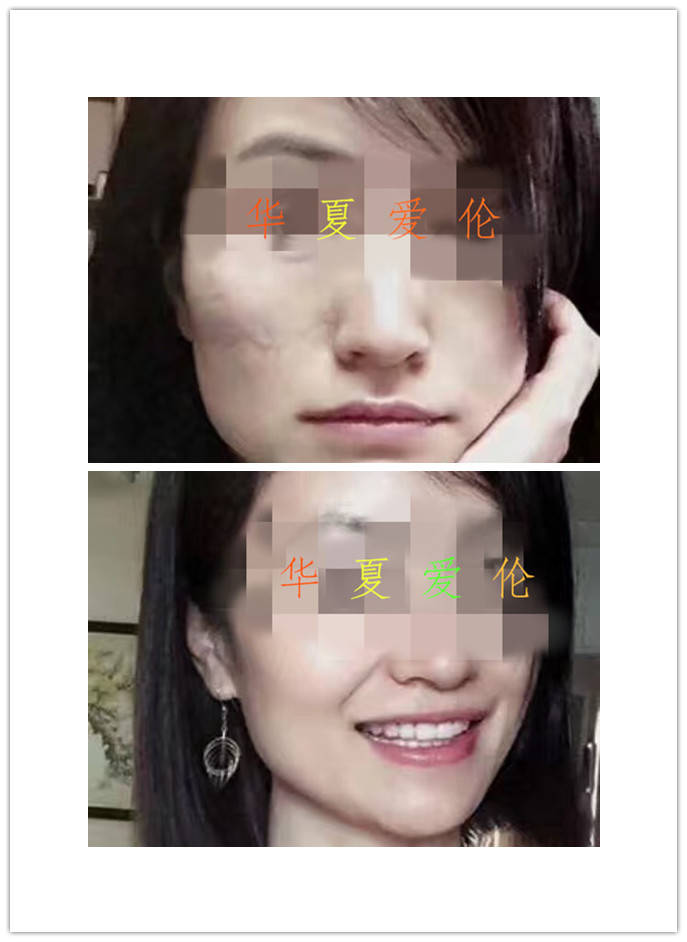 重慶*修復  重慶剖腹產(chǎn)*  重慶如何* 重慶手術(shù)*