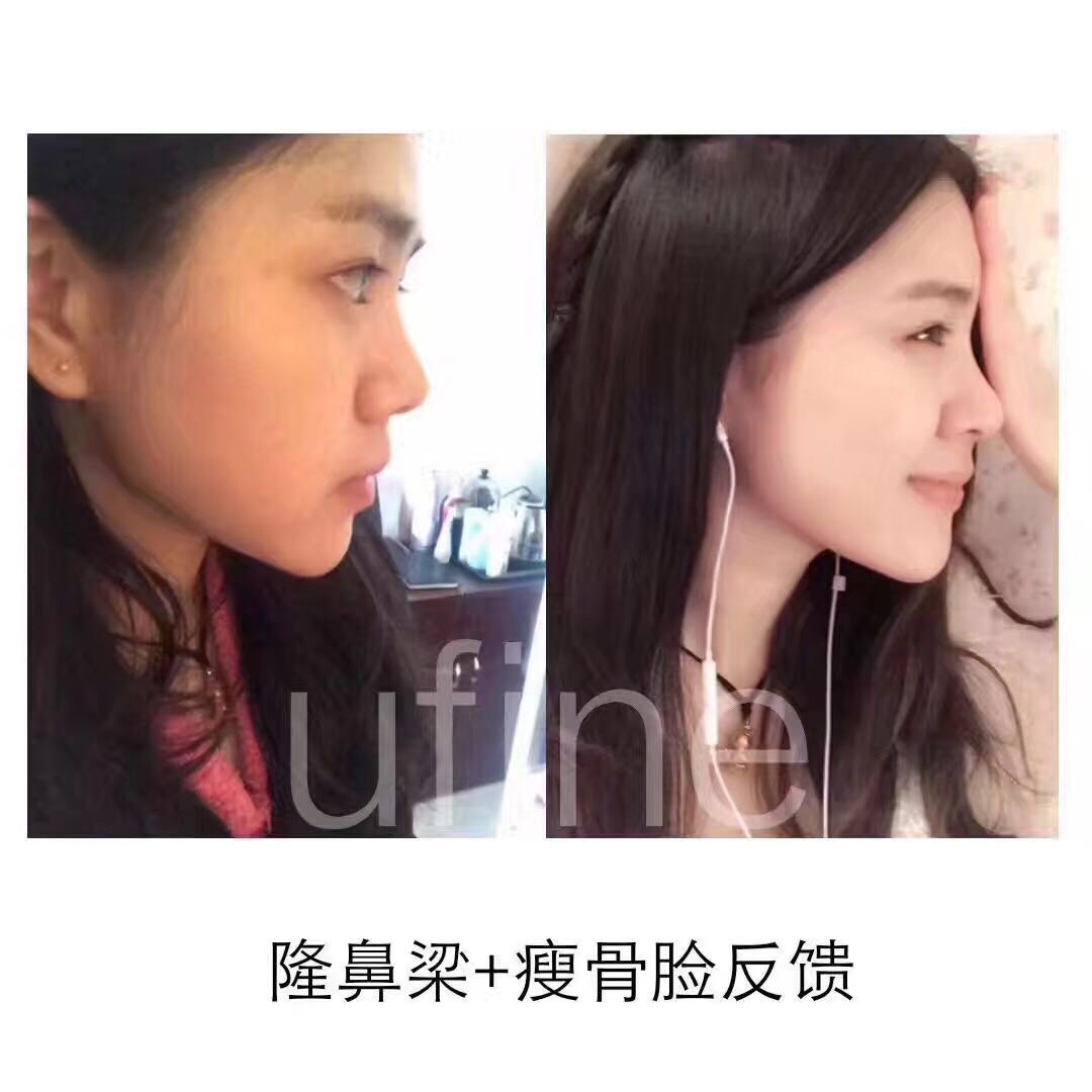 ufine精油好用嗎 ufine優(yōu)梵精油小伴侶有*嗎