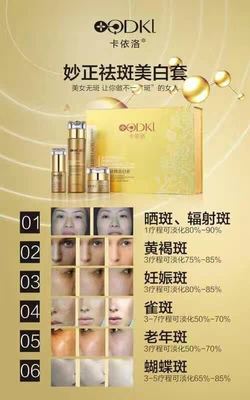 正品卡依洛妙正品卡依洛妙正化妝品三件套美白祛斑霜298元