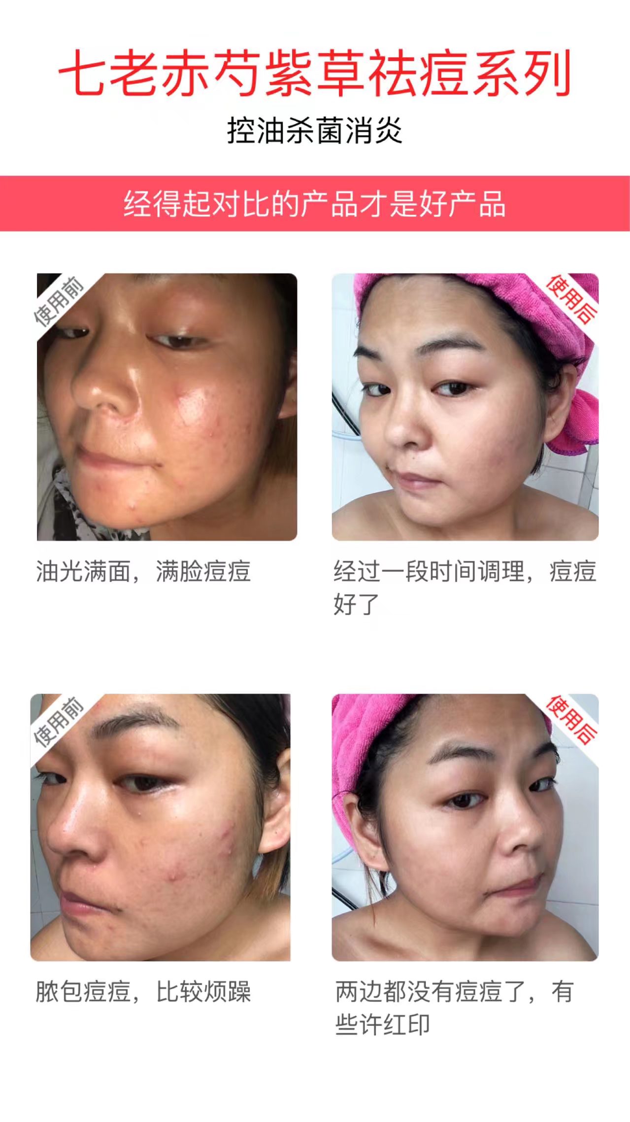 七老護(hù)膚品祛痘效果好嗎,七老護(hù)膚 七老總經(jīng)銷(xiāo)燕子 七老怎么代理