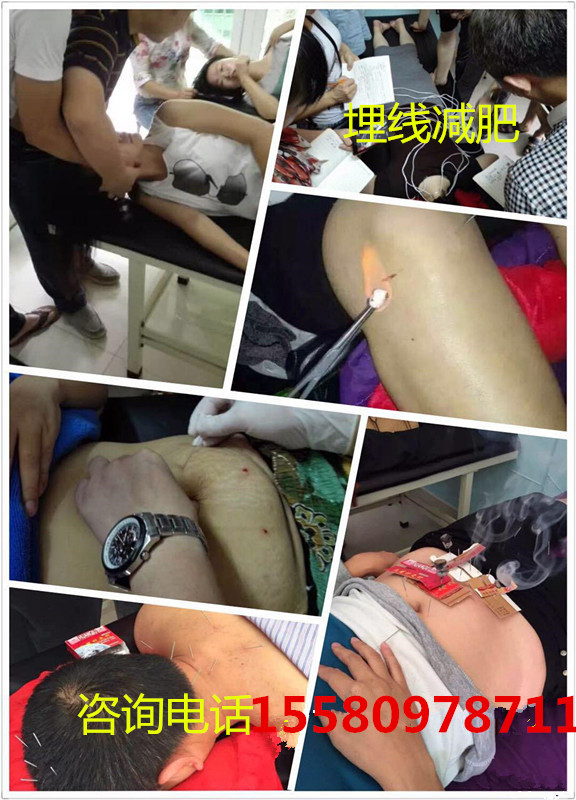 佛山哪里有學(xué)中醫(yī)針灸比較便宜教學(xué)