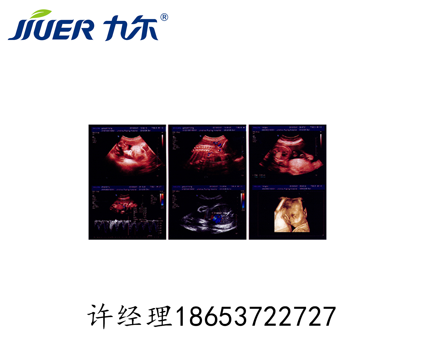 醫(yī)用X光膠片 醫(yī)用X光膠片B超膠片