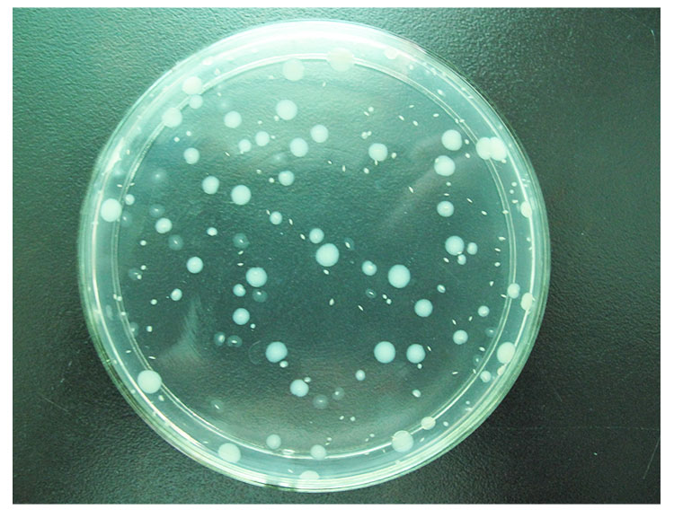 廣州花粉過(guò)敏原檢測(cè)檢測(cè)機(jī)構(gòu)中心、廣州花粉過(guò)敏原檢測(cè)公司